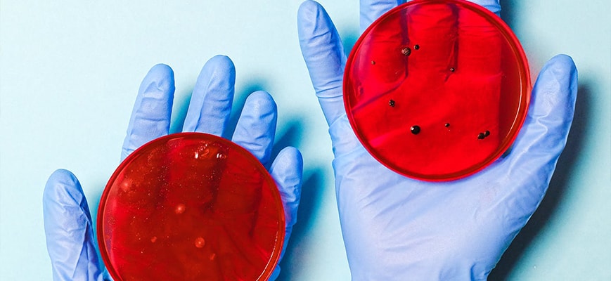 6 Superbug Myths: What Really Happens When Germs Defeat Drugs