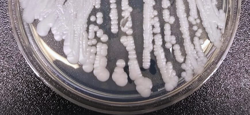 The Netherlands gets screening system for fungi, concern about outbreaks
